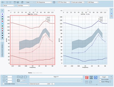 Live Speech Mapping